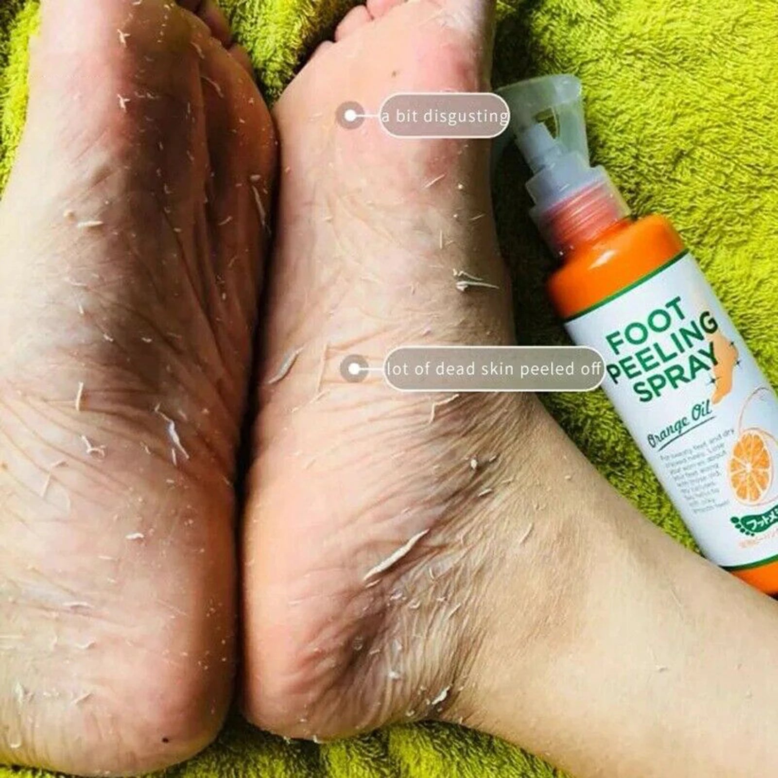 110ML Foot Peeling Spray Improve Rough Skin Available for Whole Body